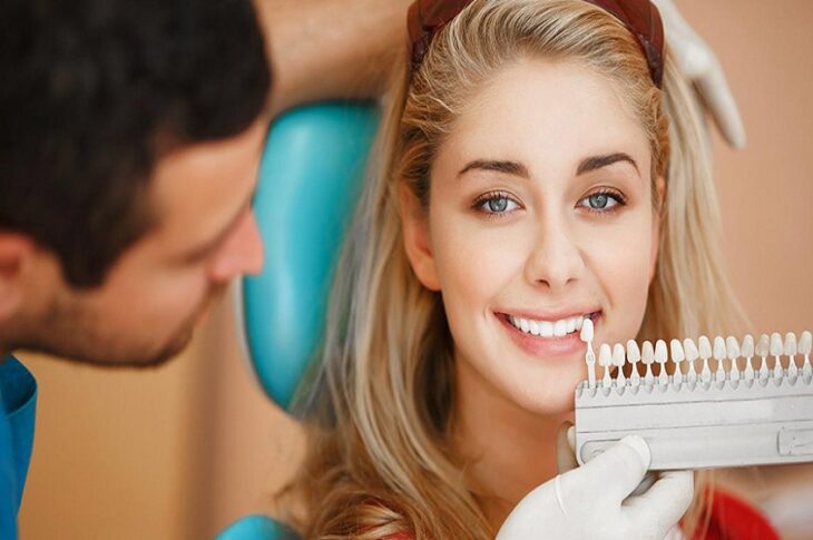 Getting Dental Veneers