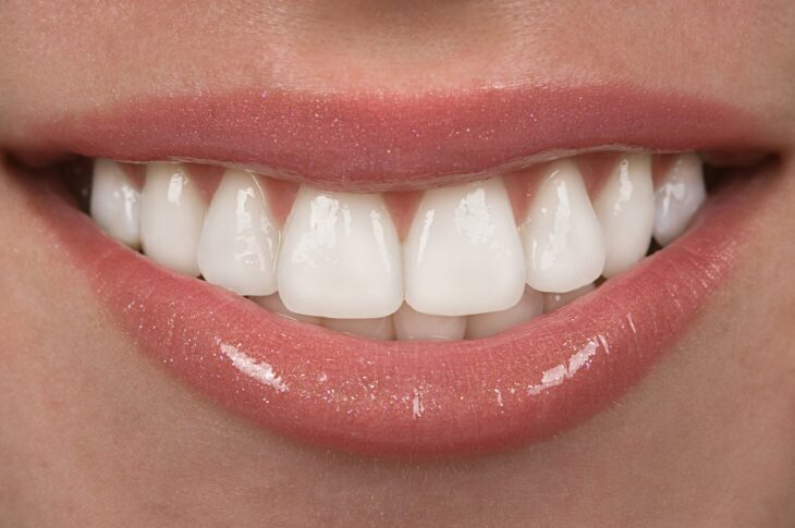 houston teeth in a day