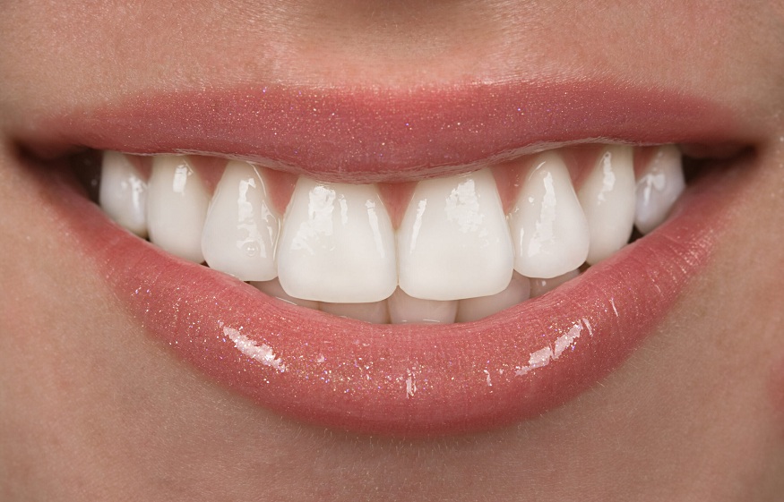 houston teeth in a day