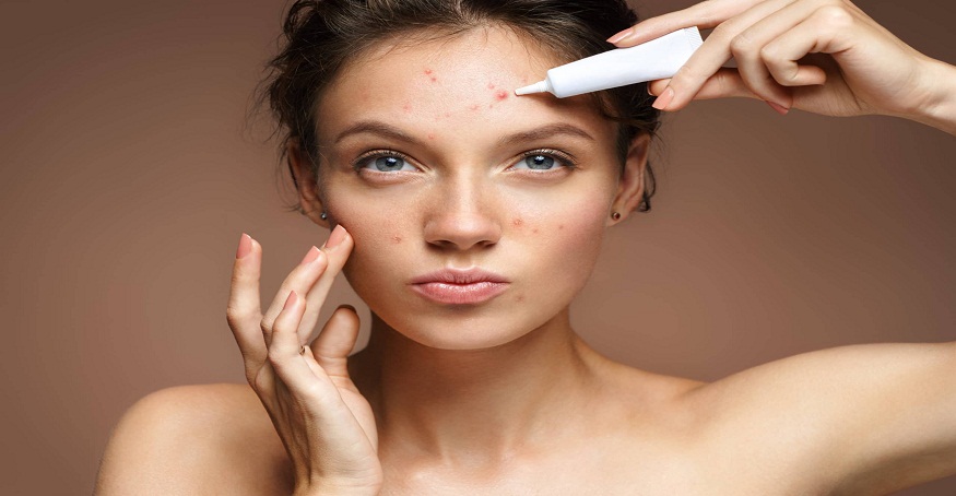 Dermatologist For Acne Treatment