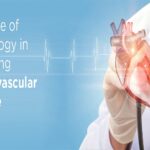 Artery Disease