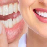 Through Cosmetic Dentistry