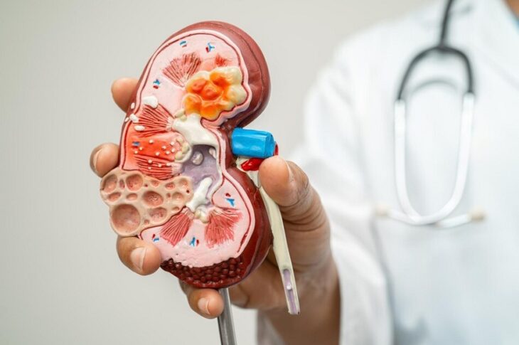Alport syndrome
