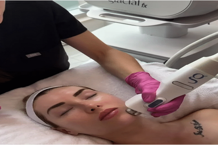laser facial