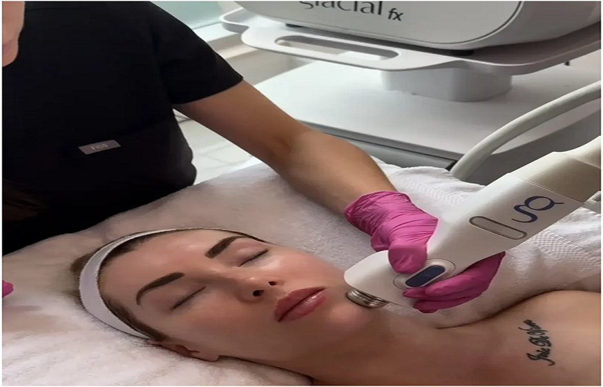 laser facial