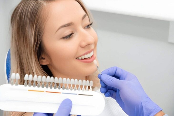 dental veneers in Vancouver, WA
